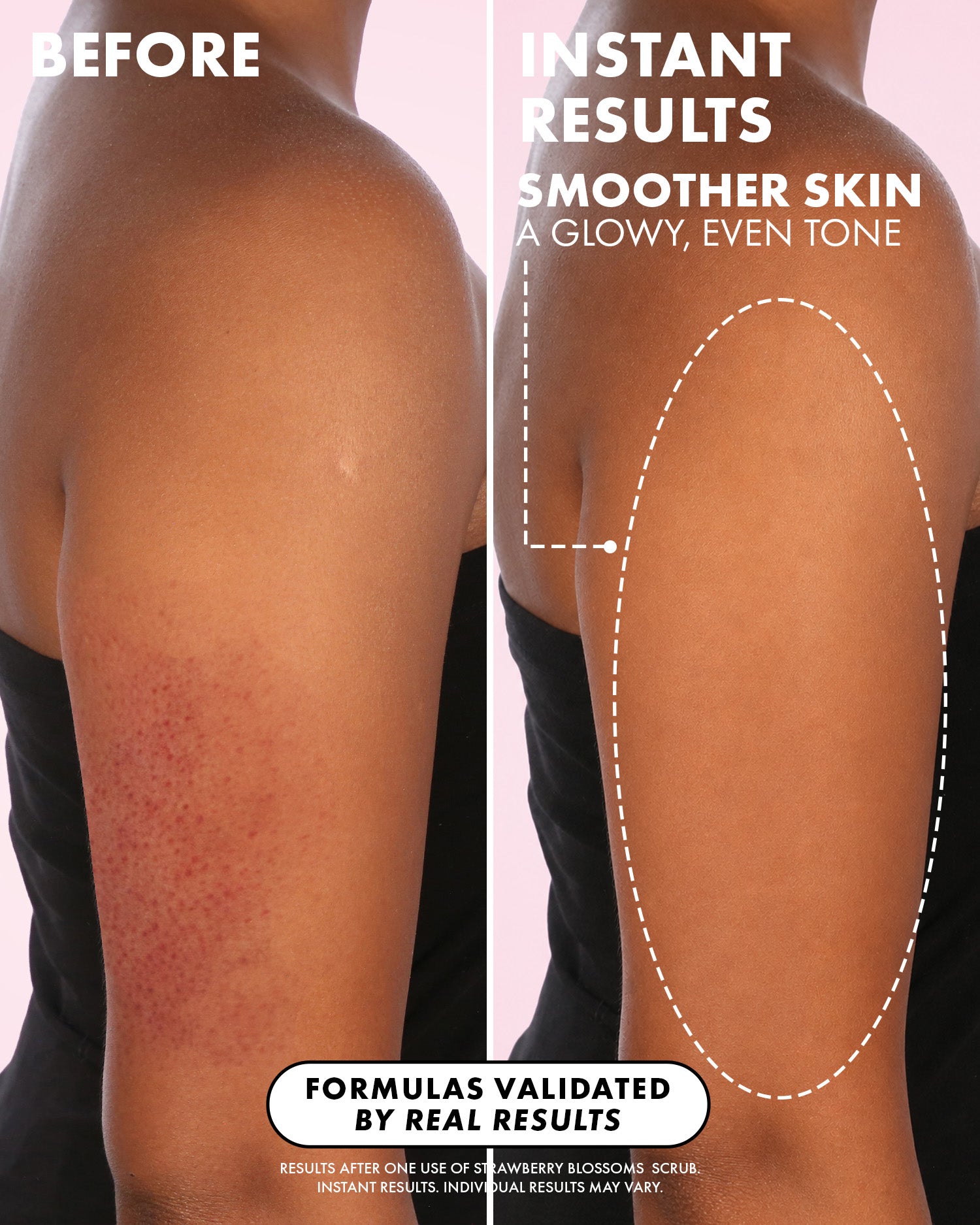 03_BeforeAfter_StrawberryBlossomsScrub_Truly_Amazon_PDP_1500x1875_720f104e-a827-410e-ae44-4b1a0868c2ab.jpg