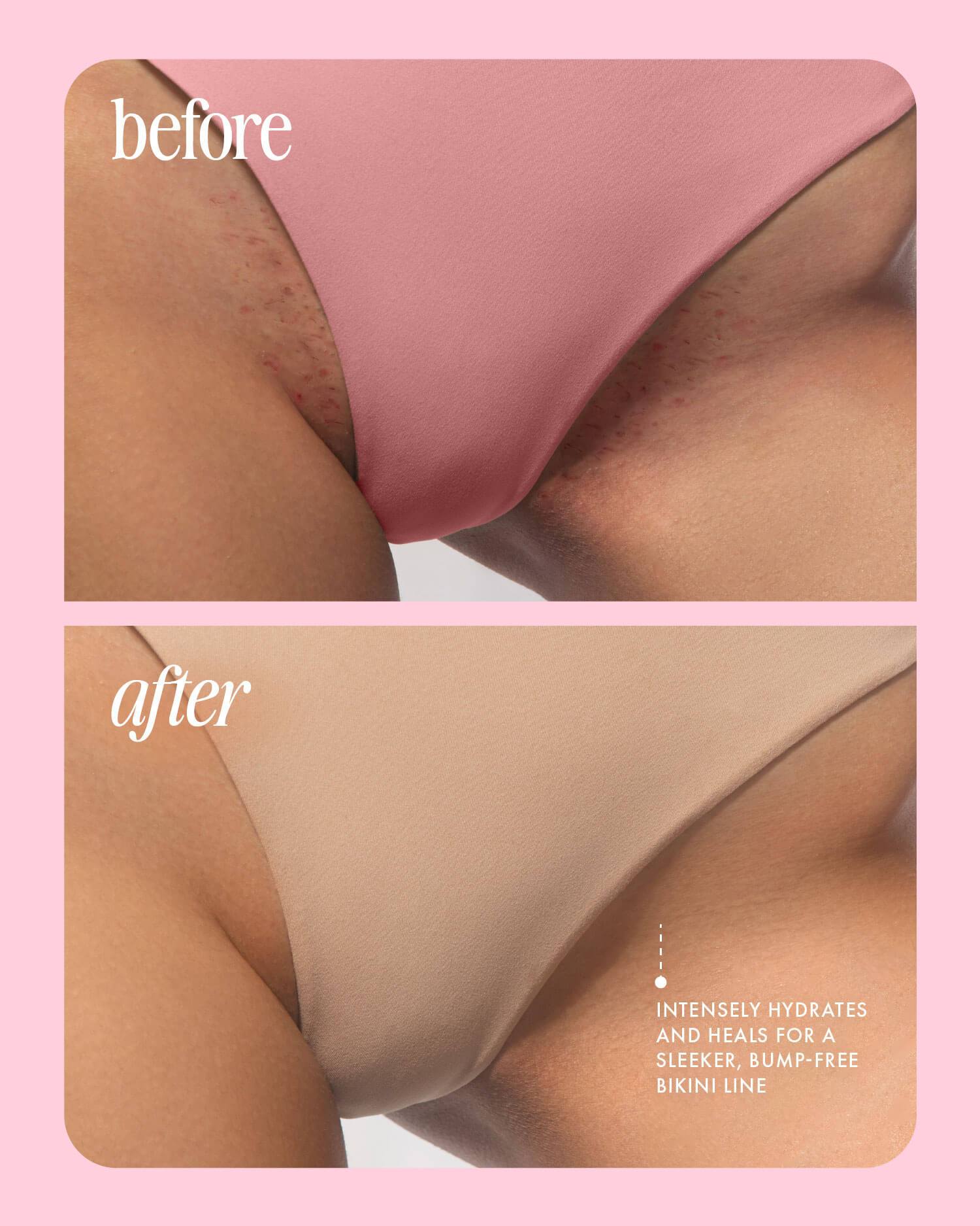 BEFOREAFTER_b0b276d0-2eab-49ed-b8fa-b84f525d79f8.jpg